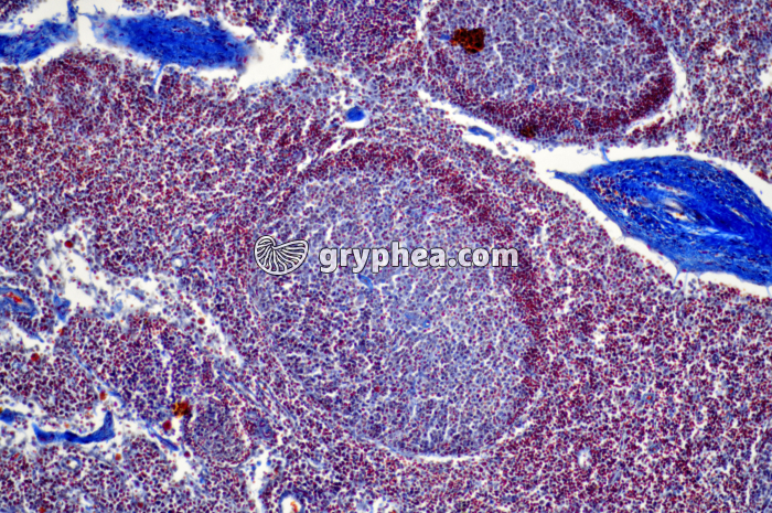 Ganglion lymphatique x40 - gryphea.com